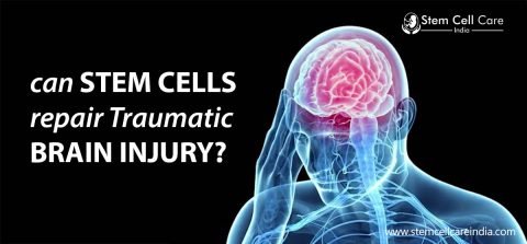 Can Stem Cells Repair Traumatic Brain Injury