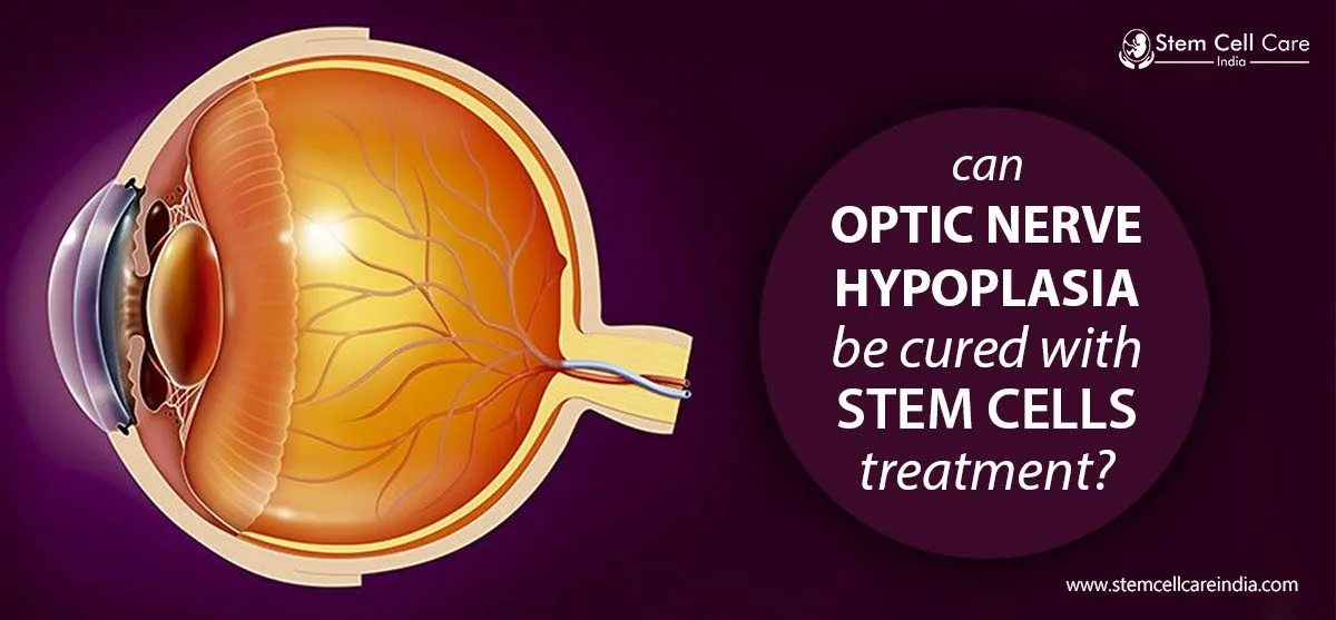 Optic Nerve Hypoplasia
