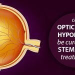 Optic Nerve Hypoplasia