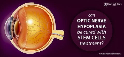 Optic Nerve Hypoplasia