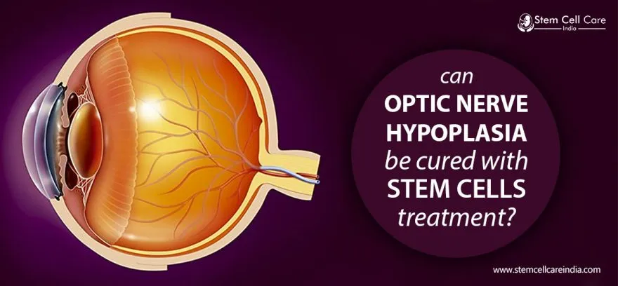 Optic Nerve Hypoplasia