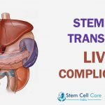Stem Cell Transplant Liver Complications