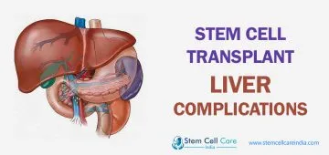Stem Cell Transplant Liver Complications