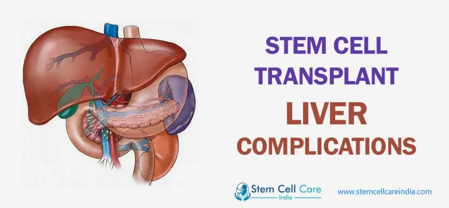 Stem Cell Transplant Liver Complications
