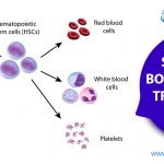Stem Cell Bone Marrow Transplant In Delhi