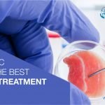 Which Clinic Provides The Best Stem Cell Treatment In India?