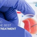 Which Is The Best Clinic For Stem Cell Therapy In India?