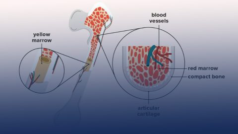 Stem Cell Treatment of Bone Marrow Transplant In Delhi