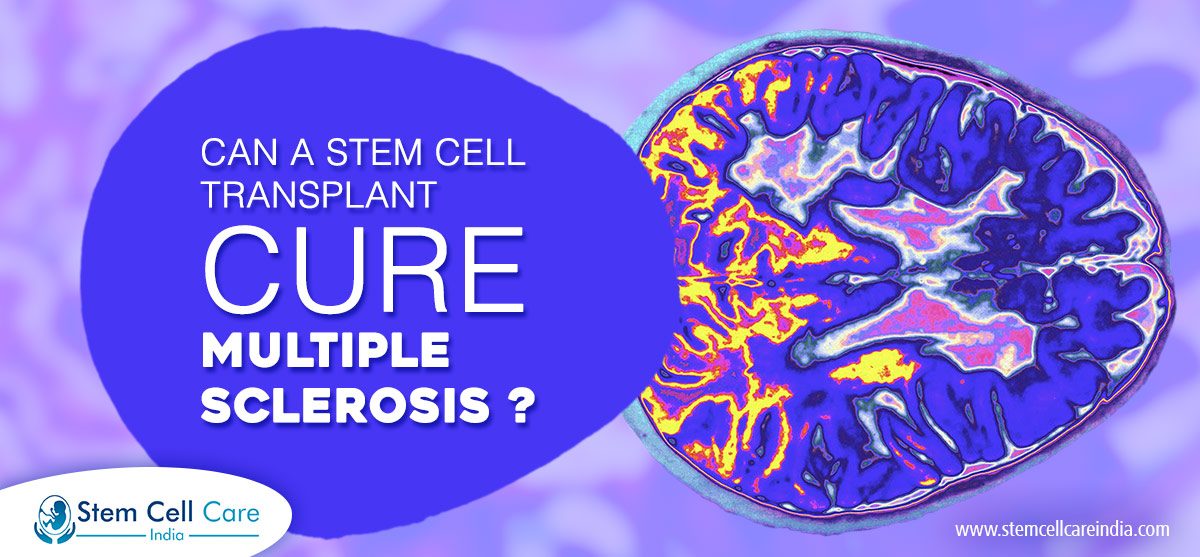 Can A Stem Cell Transplant Cure Multiple Sclerosis?