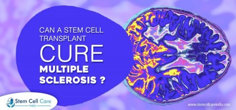 Can A Stem Cell Transplant Cure Multiple Sclerosis?