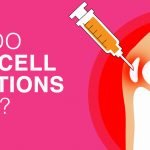 How Do Stem Cell Injections Work?