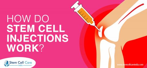How Do Stem Cell Injections Work?