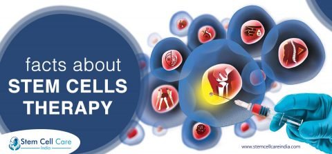 Facts About Stem Cell Therapy