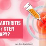 Can Osteoarthritis Be Cured By Stem Cell Therapy?