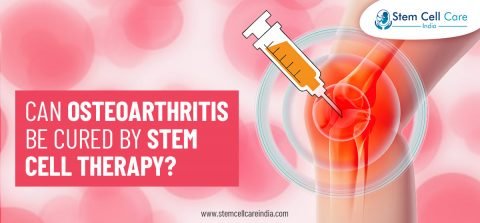 Can Osteoarthritis Be Cured By Stem Cell Therapy?