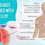What Diseases Can Be Cured With Stem Cells?