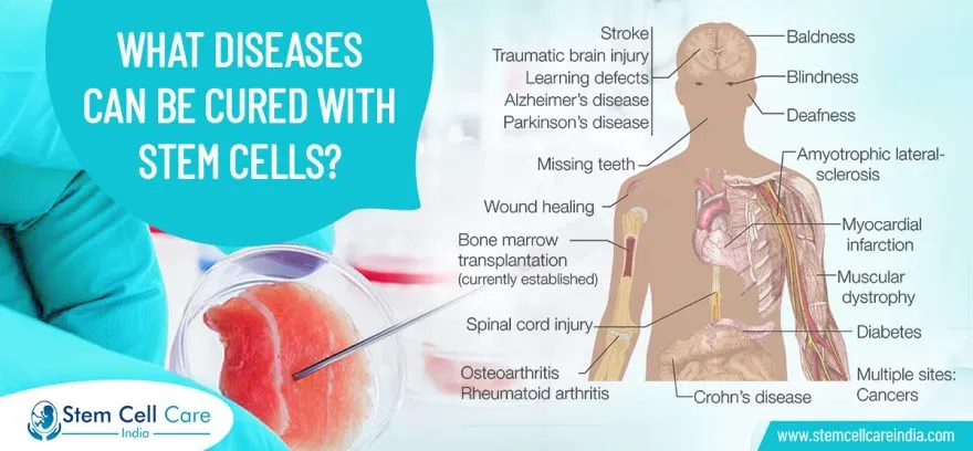 What Diseases Can Be Cured With Stem Cells?