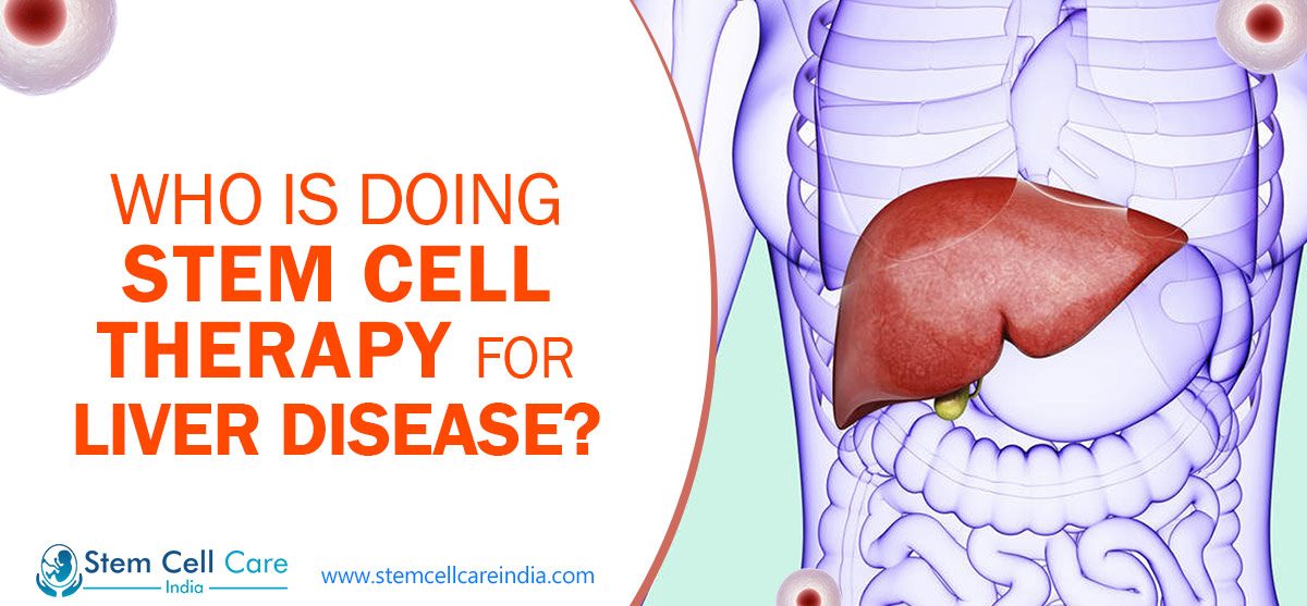 Who Is Doing Stem Cell Therapy For Liver Disease