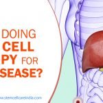 Who Is Doing Stem Cell Therapy For Liver Disease