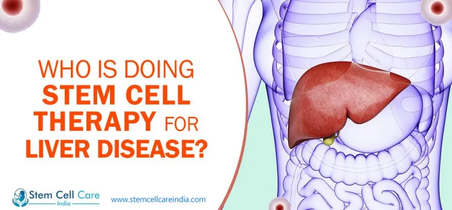 Who Is Doing Stem Cell Therapy For Liver Disease