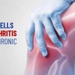 Using Stem Cells to Fight Arthritis and Other Chronic Diseases