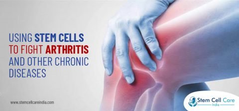 Using Stem Cells to Fight Arthritis and Other Chronic Diseases