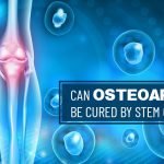 Can Osteoarthritis Be Cured By Stem Cell Therapy?