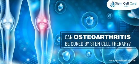 Can Osteoarthritis Be Cured By Stem Cell Therapy?