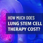 How Much Does Lung Stem Cell Therapy Cost?