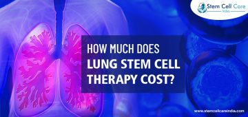 How Much Does Lung Stem Cell Therapy Cost?