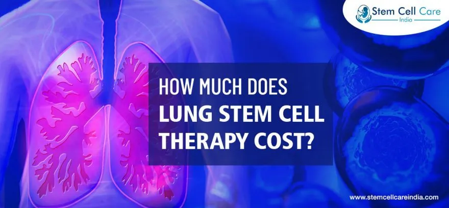 How Much Does Lung Stem Cell Therapy Cost?