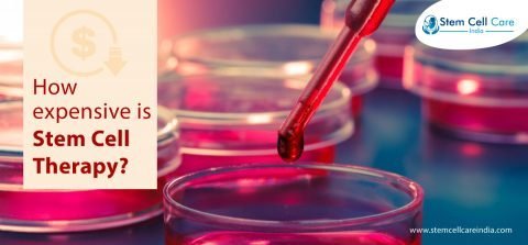 How Expensive Is Stem Cell Therapy?