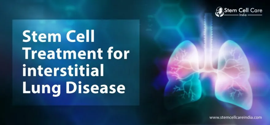 Stem Cell Treatment For Interstitial Lung Disease