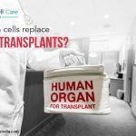 Can Stem Cells Replace Organ Transplants?