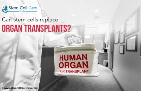 Can Stem Cells Replace Organ Transplants?