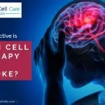 How Effective Is Stem Cell Therapy for Stroke