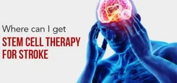 Stem Cell Therapy For Stroke