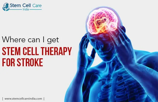 Stem Cell Therapy For Stroke