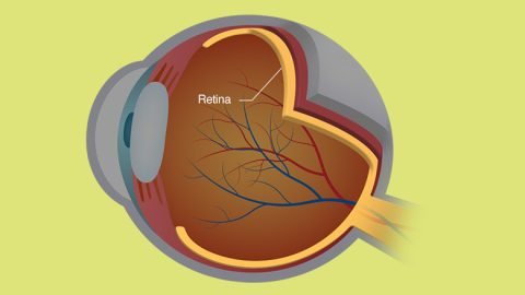 Stem Cell Treatment for Retinal Detachment