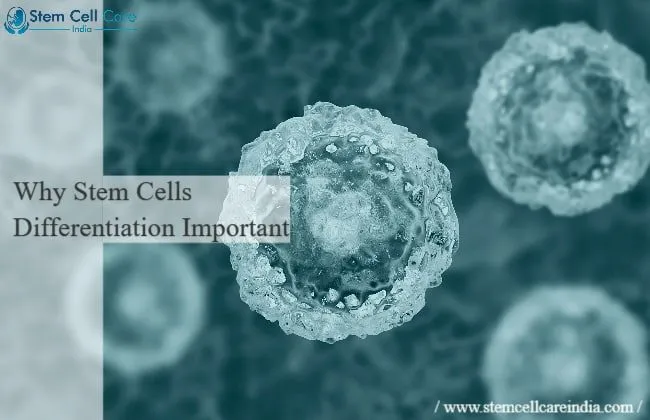 Why Stem Cells Differentiation Important