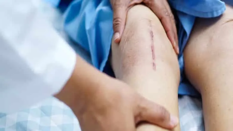 FDA Approves New Clinical Experiment Using Stem Cells to Treat Non-Healing Wounds