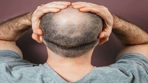 Hair Growth Encouraged Using Stem Cells