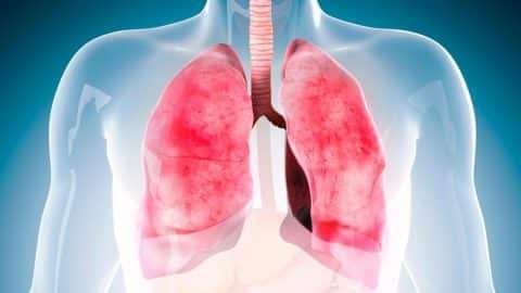 Stem Cell Therapy Might Help Treat Lung Inflammation and Damage Study