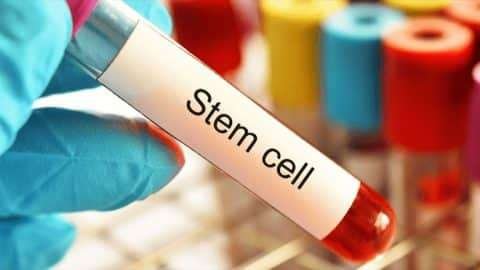 Stem Cell Treatment