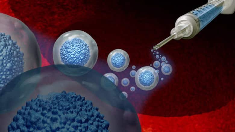 Stem Cell Treatment