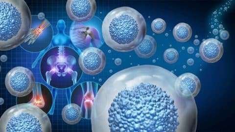 Stem Cell Treatment
