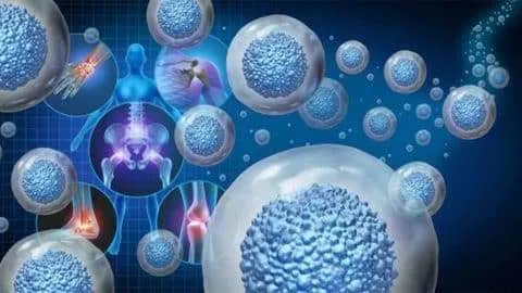 Stem Cell Treatment