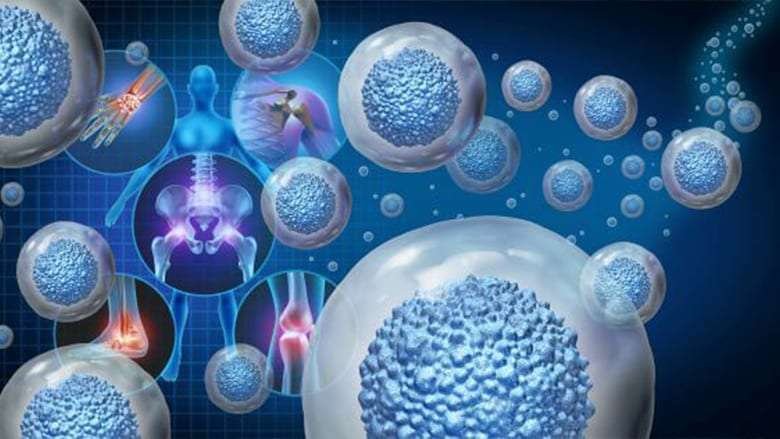 Stem Cell Treatment