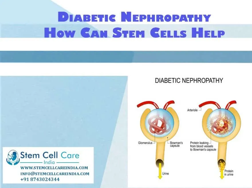 Stem Cell Therapy