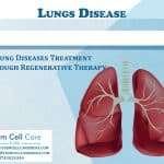 Stem Cells for Lung Disease